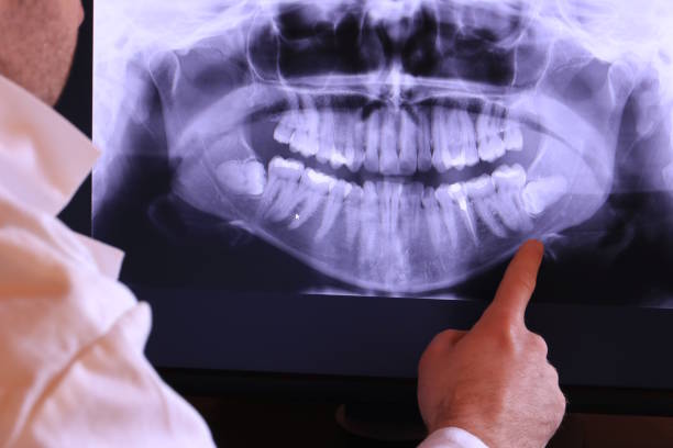 Best Chipped Tooth Repair Near Me  in Greenhills, OH