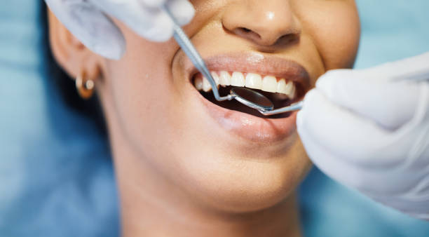 Urgent Tooth Repair in OH