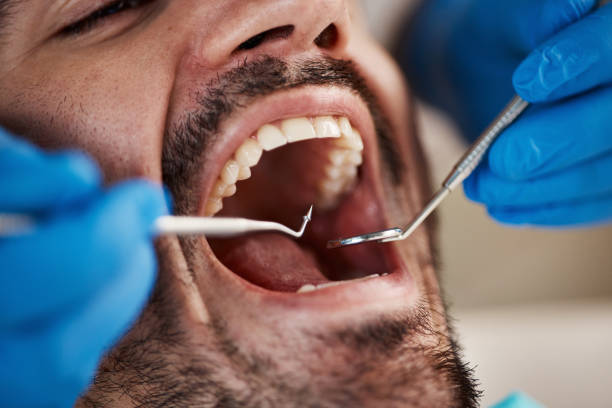 Best Broken Tooth Emergency  in Greenhills, OH